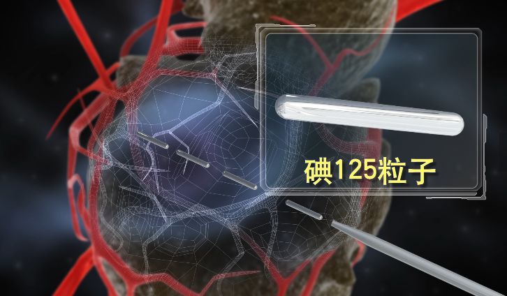 圖片1、小粒子，大能量.jpeg